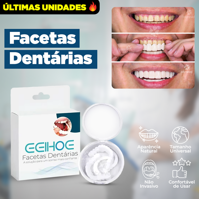 SmileFit - Facetas Dentárias Naturais Removíveis (Superior e Inferior)